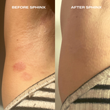 Sphinx Body Experience Oil | For Eczema and Roseacea Relief