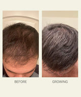 Activating Serum 3-Pack