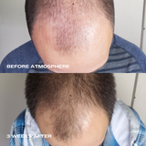 Atmosphere Multi-Peptide Hair Density & Scalp Serum