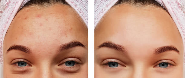 Fade Away Peptide Serum with HA + Vit. C | Anti-Aging & Lighten Sun spots- DISCONTINUED ONCE SOLD OUT